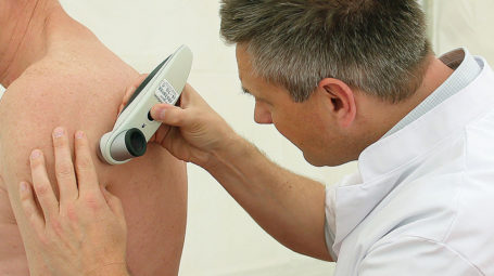 Dermatologen van Tergooi in actie tijdens Nationale Huidkankerdag